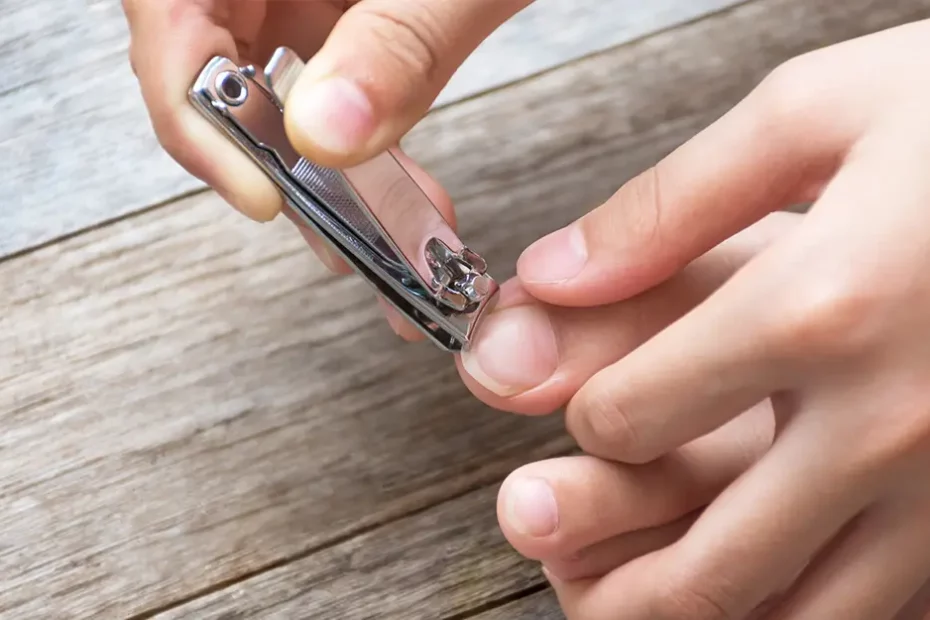 How to Fix a Cracked Toenail