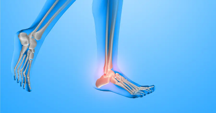 Heel Pain