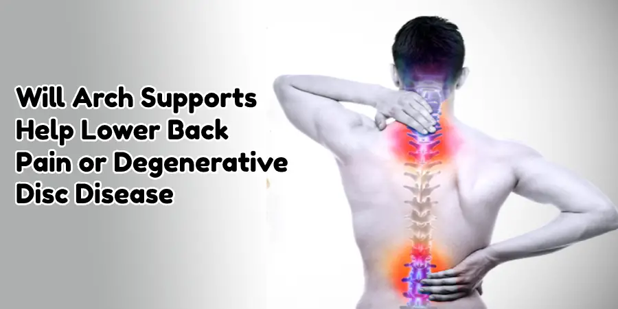 Will Arch Supports Help Lower Back Pain or Degenerative Disc Disease?