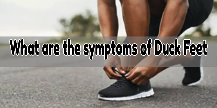 What are the symptoms of Duck Feet?
