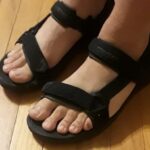 Best Sandals for Swollen Feet