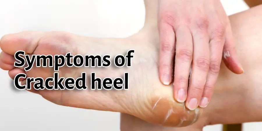 Symptoms of Cracked heel