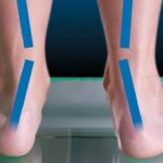 Best Women's Cross Training Shoes for Overpronation