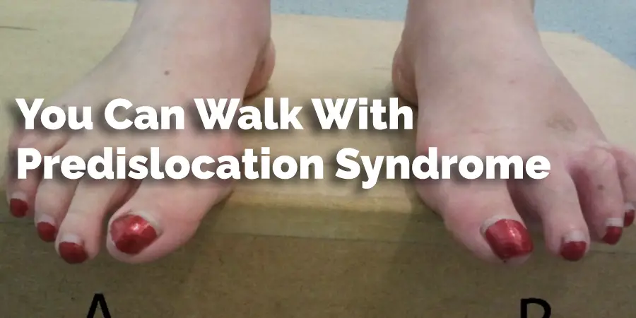 You Can Walk With Predislocation Syndrome