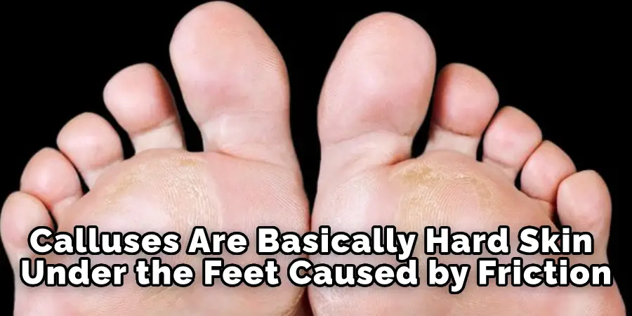 Les callosités sont essentiellement de la peau dure sous les pieds, causée par le frottement.