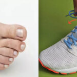 How to Lace Running Shoes for Numb Toes