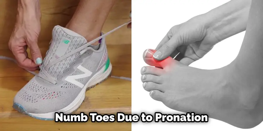 Numb Toes Due to Pronation