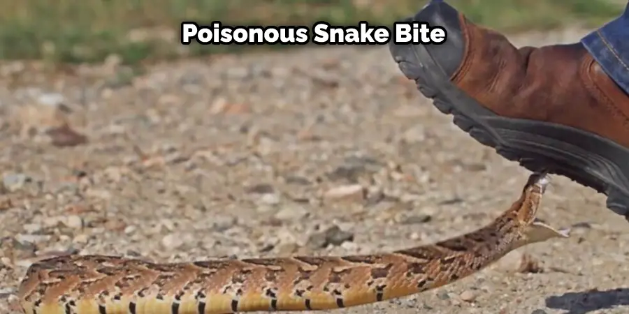 Poisonous Snake Bite