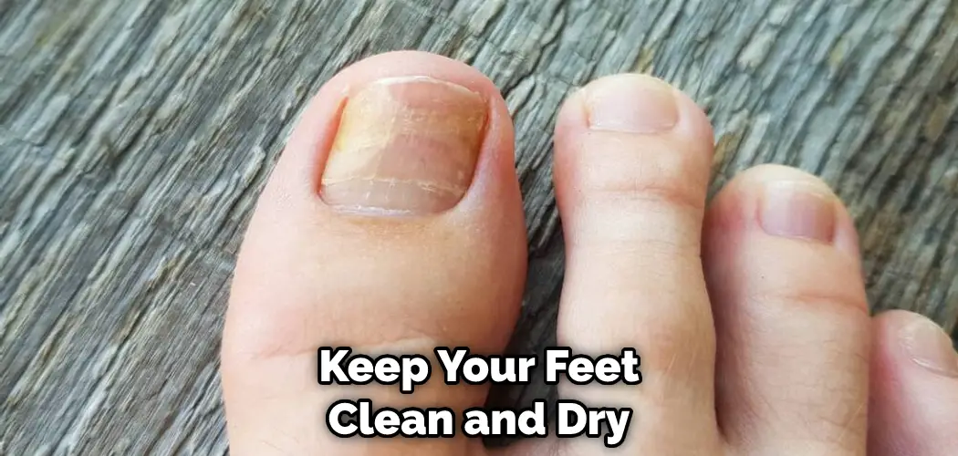 Keep Your Feet Clean and Dry