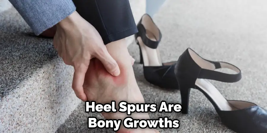 Heel Spurs Are Bony Growths